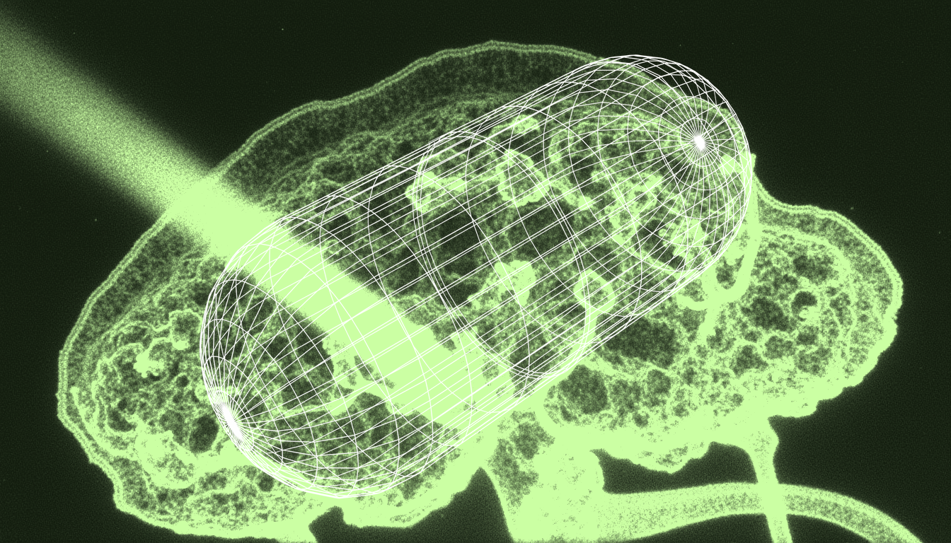 Focused ultrasound beam penetrating neural tissue in basal ganglia, monochrome transmitted illumination, high-resolution cellular detail